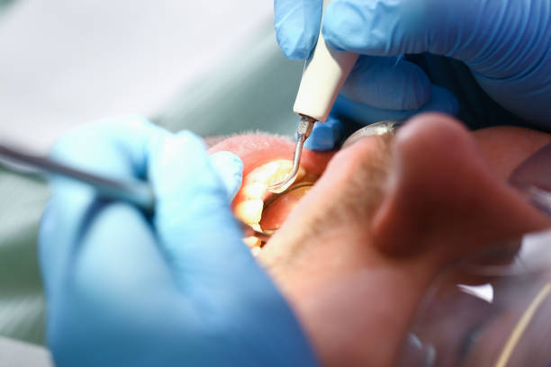 Best Emergency Dental Extractions in Prairie Ridge, WA